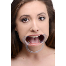 Load image into Gallery viewer, Cheek Retractor Dental Mouth Gag