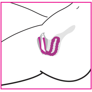 Petal Pusher Silicone Labia Spreader