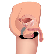 Load image into Gallery viewer, 7X Silicone Prostate Plug with Ball Stretcher and Remote